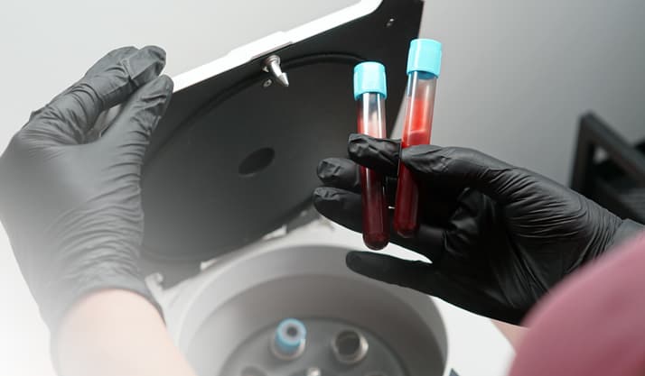 PRP Autologous Blood Therapy