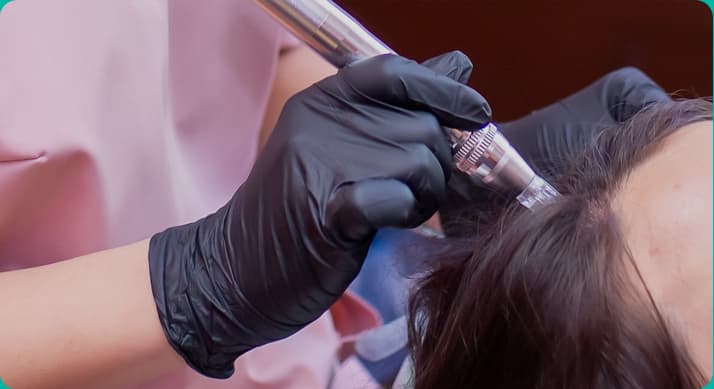 Scalp Scaling