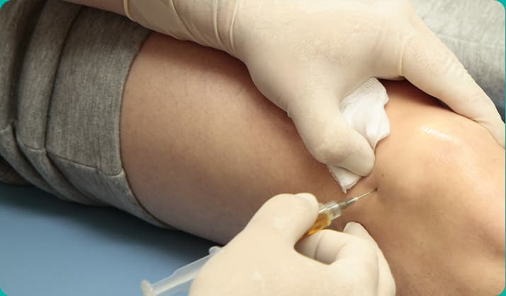 Joint Pain Stem Cell Therapy