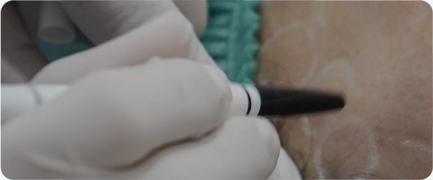 Visible Results Backed by Extensive Treatment Experience image