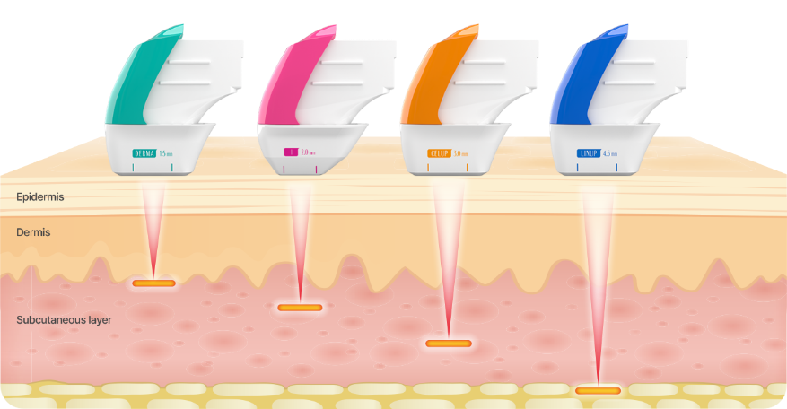 Customized 1:1 Treatment with Collagen Volume Design image