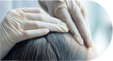 Hair Loss/Scalp