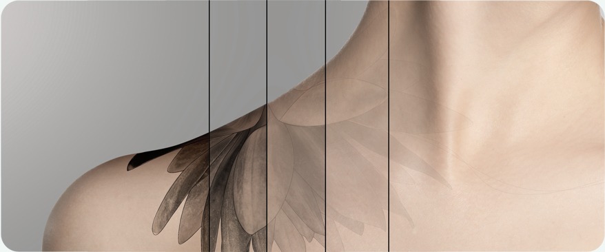 Visible Results Backed by Extensive Treatment Experience image