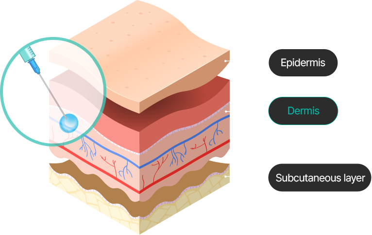 Treatment process image