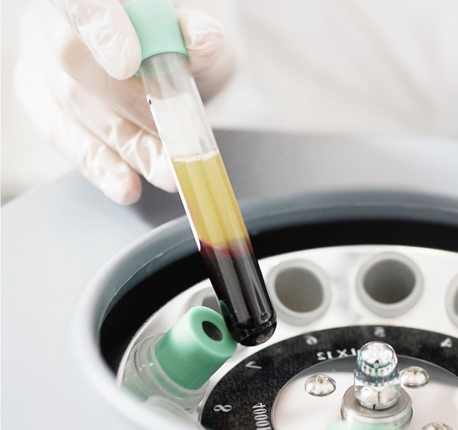Autologous Blood Skin Booster image