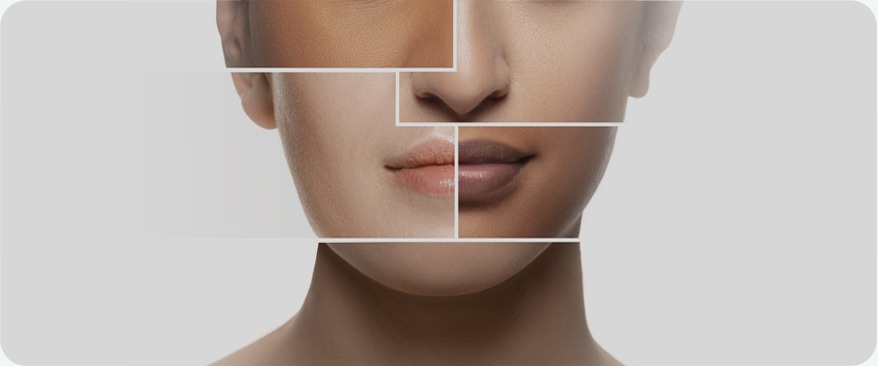 Customized 1:1 Treatment with Collagen Volume Design image