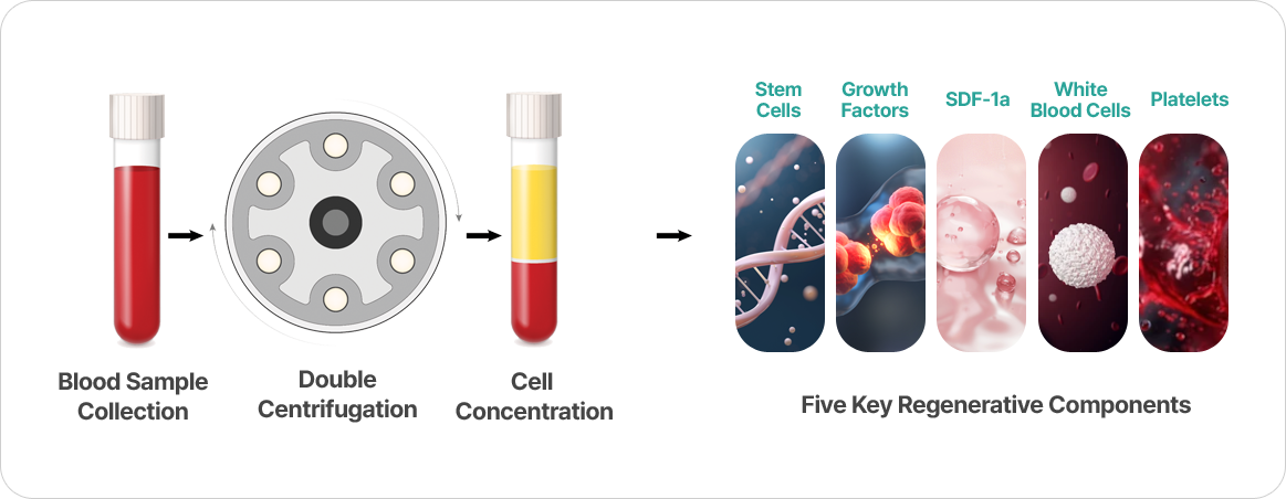 Autologous Blood Skin Booster Treatment Process image
